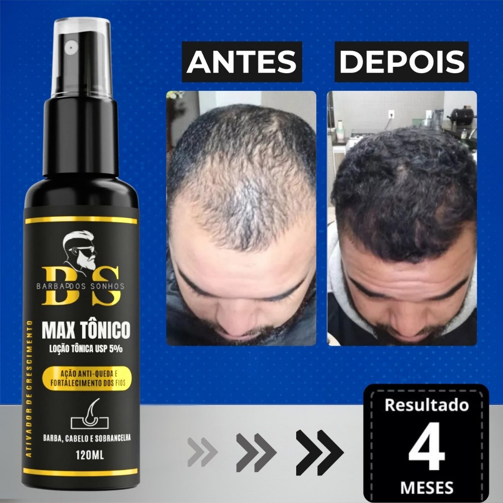 Tônico de Crescimento e Antiqueda para Cabelo, Barba e Sobrancelha – Barba dos Sonhos